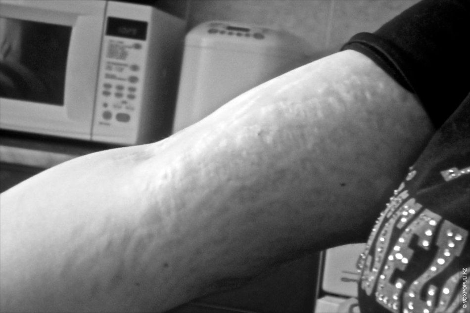 Кристина Романова, девушка в инвалидном кресле, которая учится ходить и помогает людям через электронное правительство, врачебная ошибка, электронное правительство, особое мнение, Арти Ферзаули, вдохновляющие истории, инклюзия, реабилитация, инвалиды Казахстана, Call-центр