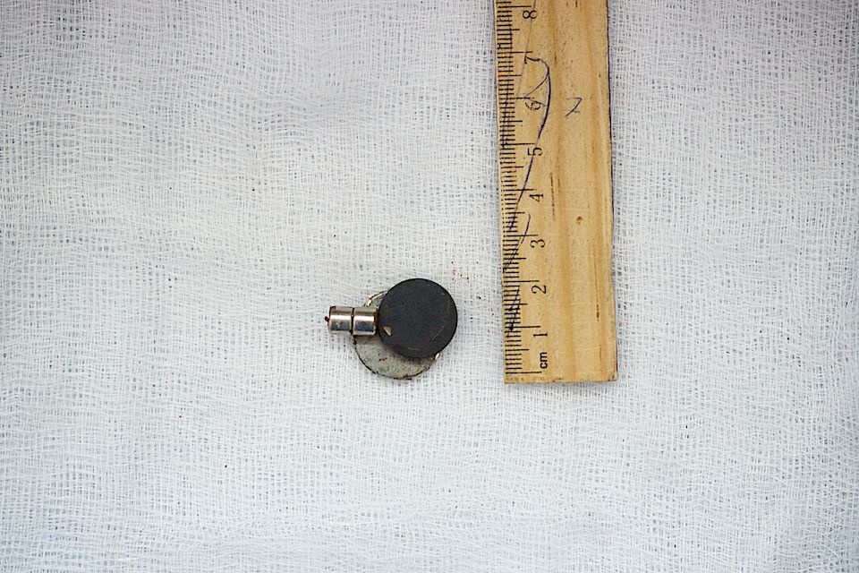 Детская хирургия Алматы: врачи спасают малышей, проглотивших инородные предметы, и предупреждают родителей об опасности повседневных вещей, детская больница, Алматы, хирургия, медицина, безопасность детей, инородные тела, врачи, дети, Карлыгаш Нуржан, Shanger.kz