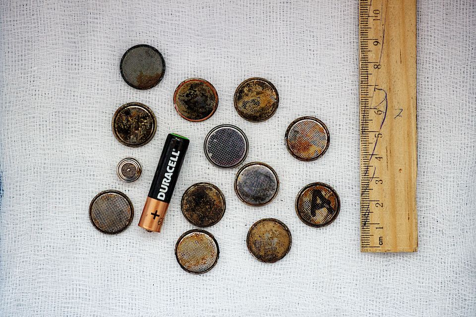 Детская хирургия Алматы: врачи спасают малышей, проглотивших инородные предметы, и предупреждают родителей об опасности повседневных вещей, детская больница, Алматы, хирургия, медицина, безопасность детей, инородные тела, врачи, дети, Карлыгаш Нуржан, Shanger.kz