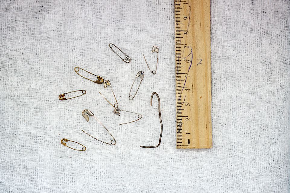 Детская хирургия Алматы: врачи спасают малышей, проглотивших инородные предметы, и предупреждают родителей об опасности повседневных вещей, детская больница, Алматы, хирургия, медицина, безопасность детей, инородные тела, врачи, дети, Карлыгаш Нуржан, Shanger.kz