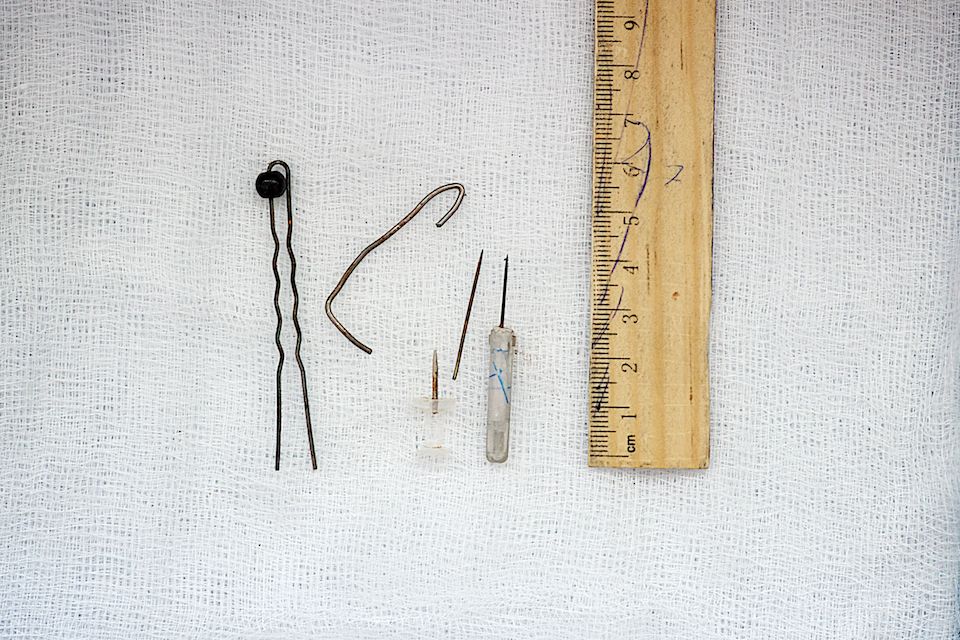 Детская хирургия Алматы: врачи спасают малышей, проглотивших инородные предметы, и предупреждают родителей об опасности повседневных вещей, детская больница, Алматы, хирургия, медицина, безопасность детей, инородные тела, врачи, дети, Карлыгаш Нуржан, Shanger.kz