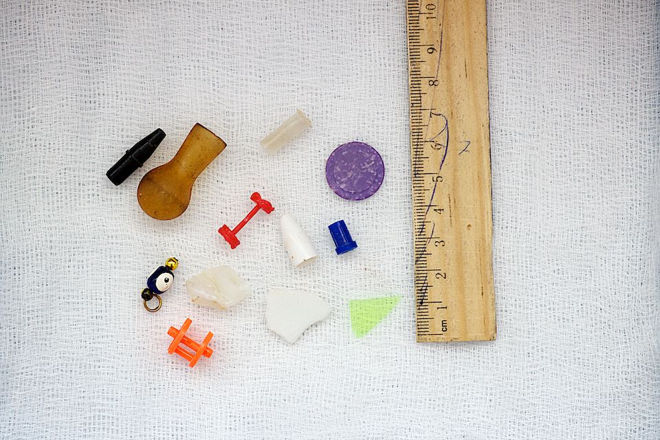 Детская хирургия Алматы: врачи спасают малышей, проглотивших инородные предметы, и предупреждают родителей об опасности повседневных вещей, детская больница, Алматы, хирургия, медицина, безопасность детей, инородные тела, врачи, дети, Карлыгаш Нуржан, Shanger.kz