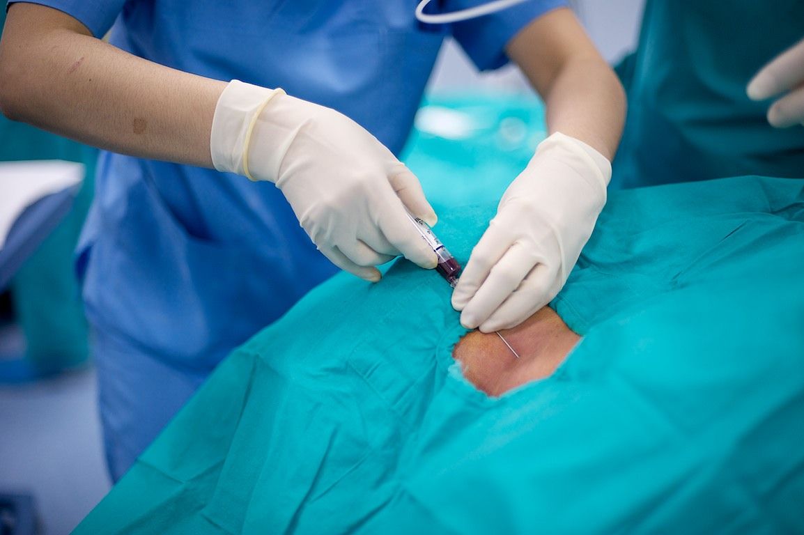 Операция на открытом сердце в клинике Almaty Sema Hospital: команда хирургов и пациент из Кыргызстана проходят сложный путь к восстановлению жизни, кардиохирургия Казахстана, Almaty Sema Hospital, операция на сердце, Казахстан, Жамалдин Болушов, Тансель Туркоглу, Феруз Бабашов, медицина, фоторепортаж, Карла Нур