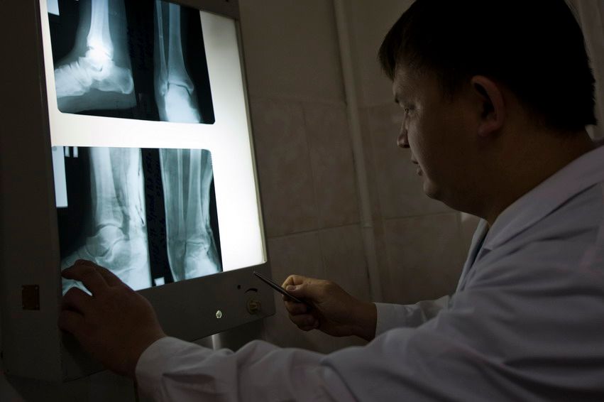 Ночная смена врачей в отделении травматологии Алматы, жизнь больницы, травматология, больница, врачи, Алматы, медицина, ночная смена, скорая помощь, пациенты, жизнь врачей, Карлыгаш Нуржан, Карла Нур, Shanger.kz