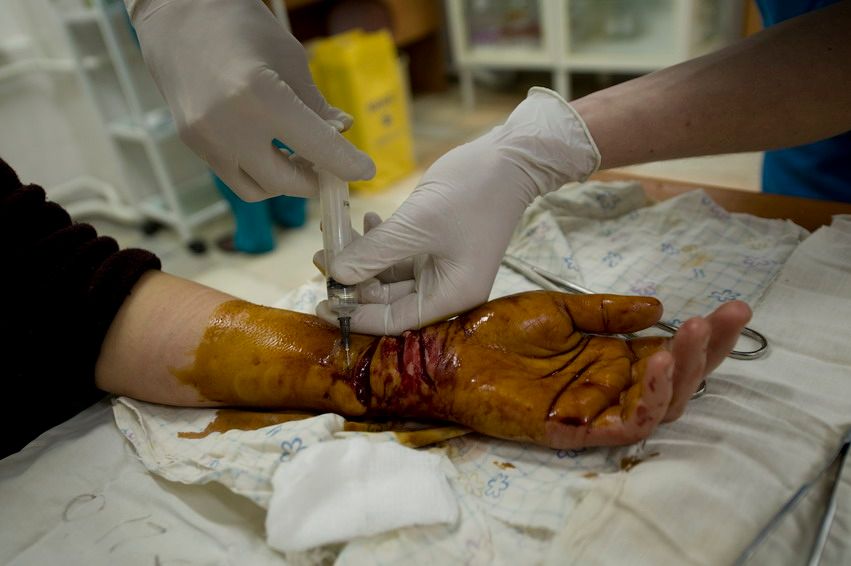 Ночная смена врачей в отделении травматологии Алматы, жизнь больницы, травматология, больница, врачи, Алматы, медицина, ночная смена, скорая помощь, пациенты, жизнь врачей, Карлыгаш Нуржан, Карла Нур, Shanger.kz