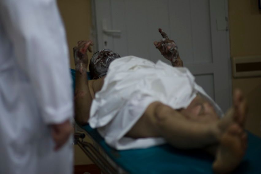 Ночная смена врачей в отделении травматологии Алматы, жизнь больницы, травматология, больница, врачи, Алматы, медицина, ночная смена, скорая помощь, пациенты, жизнь врачей, Карлыгаш Нуржан, Карла Нур, Shanger.kz